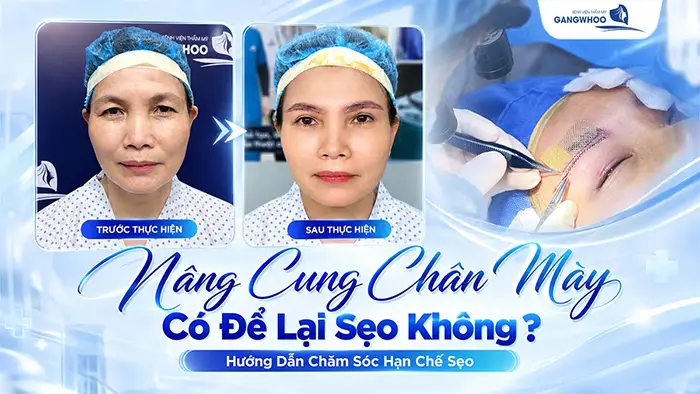 nang cung chan may co de lai seo khong