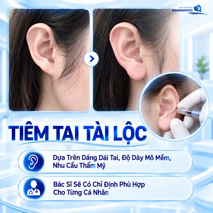 Tiêm Tai Tài Lộc Có Đau Không? Mức Độ Đau Và Cách Giảm Khó Chịu