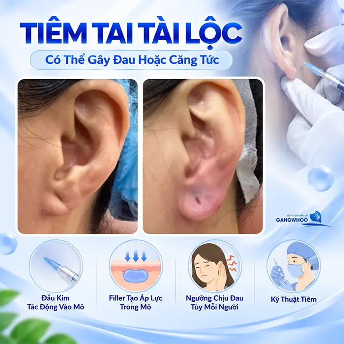 Tiêm Tai Tài Lộc Có Đau Không? Mức Độ Đau Và Cách Giảm Khó Chịu