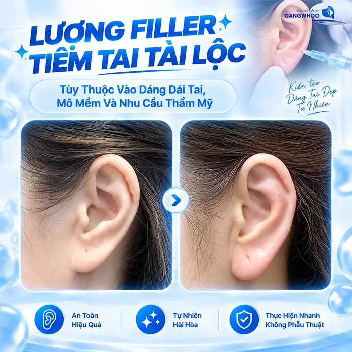 Tiêm Tai Tài Lộc Giá Bao Nhiêu? Bảng Giá Mới Năm 2026