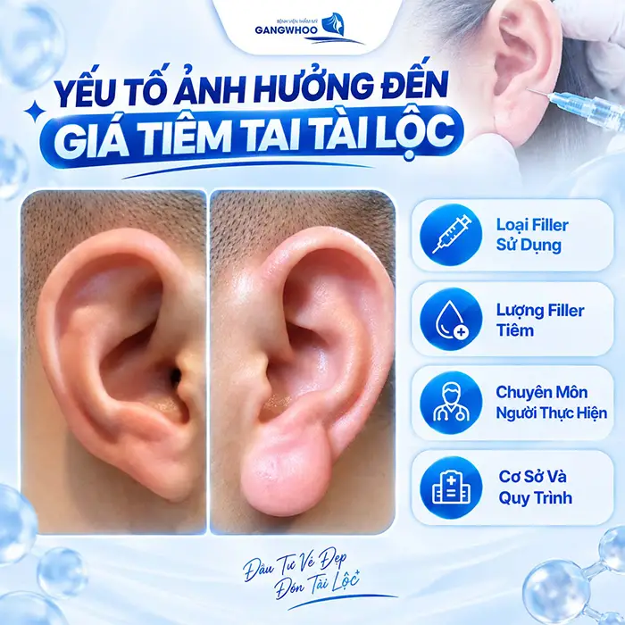 Tiêm Tai Tài Lộc Giá Bao Nhiêu? Bảng Giá Mới Năm 2026