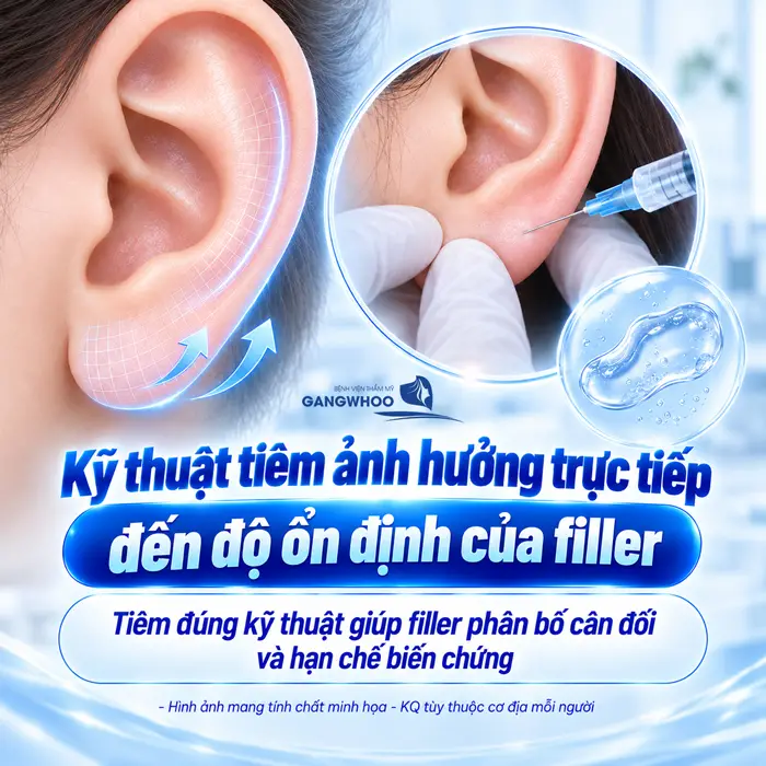 Tiêm Tai Tài Lộc Được Bao Lâu? Yếu Tố Ảnh Hưởng Nên Tiêm Lại