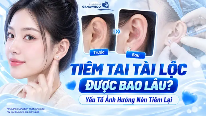 tiem tai tai loc giu duoc bao lau bv