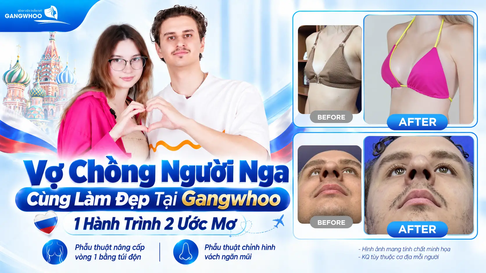 cap vo chong nguoi nga