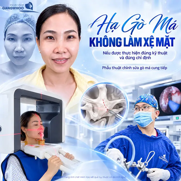 Hạ Gò Má Có Bị Xệ Mặt Không? Vì Sao Bị Xệ Mặt?