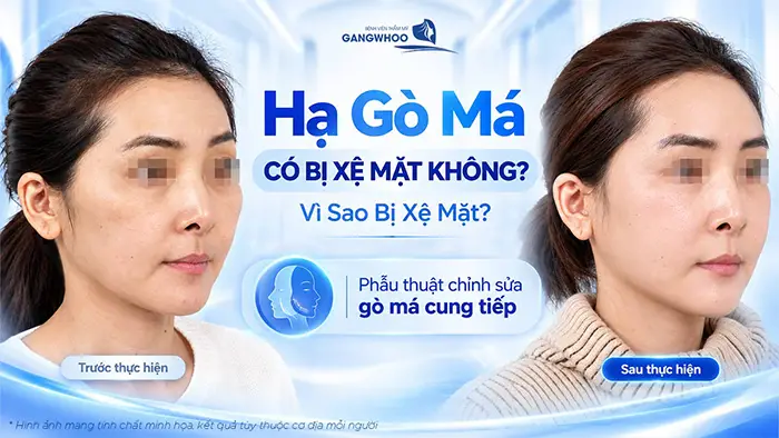 ha go ma co bi xe mat khong