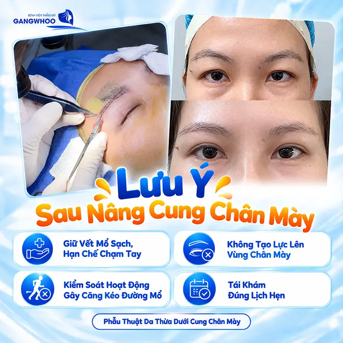 Sau Nâng Cung Chân Mày Kiêng Ăn Gì? Nên Ăn Gì Để Hỗ Trợ Hồi Phục?