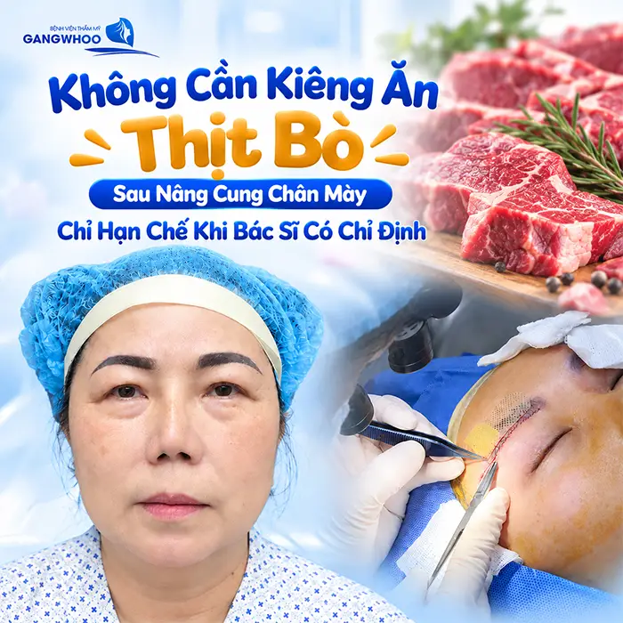 Sau Nâng Cung Chân Mày Kiêng Ăn Gì? Nên Ăn Gì Để Hỗ Trợ Hồi Phục?