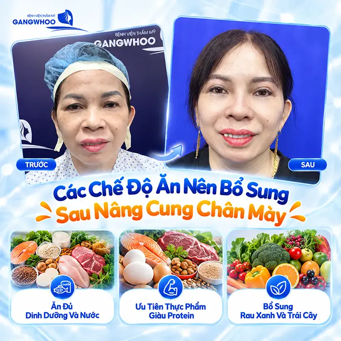 Sau Nâng Cung Chân Mày Kiêng Ăn Gì? Nên Ăn Gì Để Hỗ Trợ Hồi Phục?