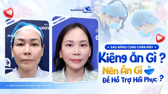 nang cung chan may kieng an gi
